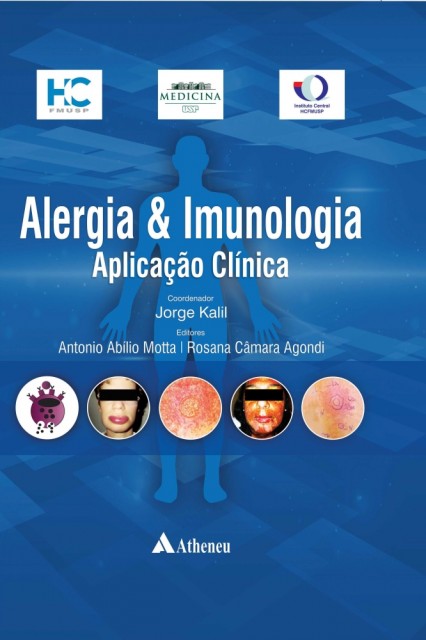 Alergia & Imunologia - Aplicação Clínica