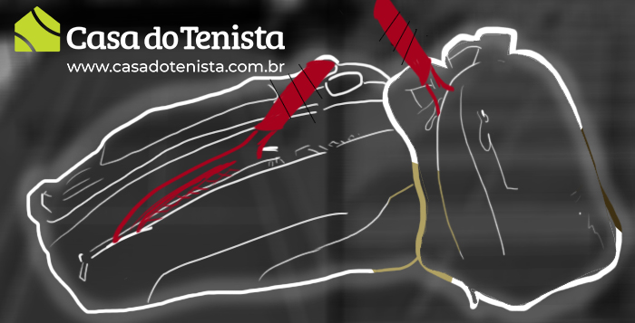 Como escolher uma mochila ou raqueteira.